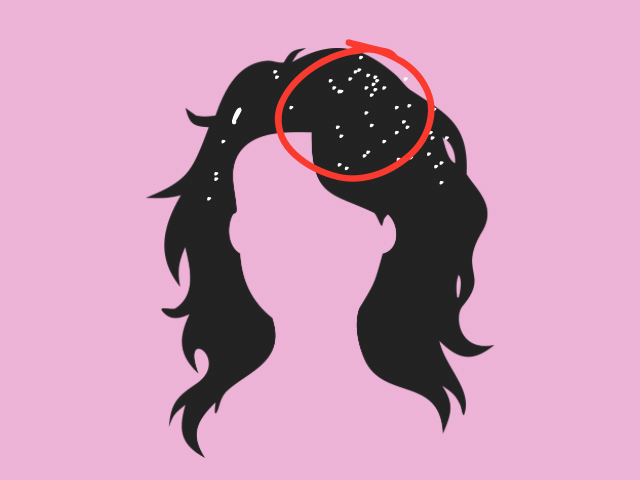 髪の毛が固まるスプレーが白く残るとき