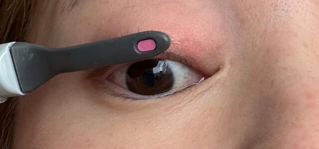 ホットビューラーの使い方